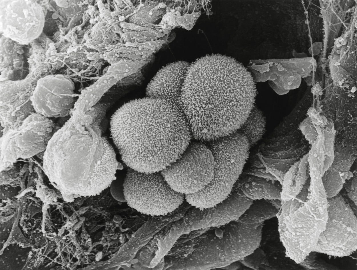 Incidența tumorilor în rândul tinerilor este în creștere, datele îi uimesc pe medici: „Înfiorător, nu știm de ce”